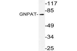 Western blot (WB) analysis of GNPAT antibody in extracts from HT-29 cells.