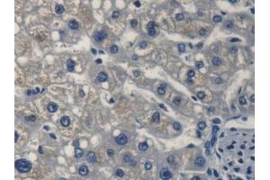 DAB staining on IHC-P; Samples: Human Liver Tissue