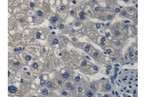 DAB staining on IHC-P; Samples: Human Liver Tissue (FKBP2 anticorps  (AA 1-142))
