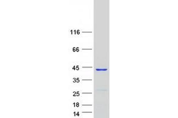 GTPBP10 Protein (Transcript Variant 2) (Myc-DYKDDDDK Tag)