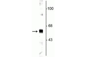 Western blot of rat cortical lysate showing specific labeling of the ~65 kDa synaptotagmin protein. (SYT1 anticorps)