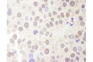 Immunohistochemistry (IHC) image for anti-Multiple Endocrine Neoplasia 1 (MEN1) (C-Term) antibody (ABIN7448666)