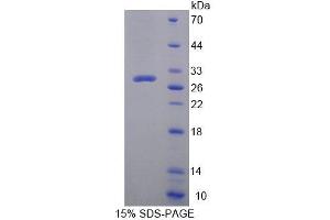 SDS-PAGE analysis of Human ACACb Protein.