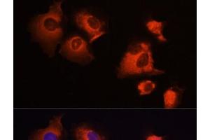 Immunofluorescence analysis of A431 cells using MCL1 Polyclonal Antibody at dilution of 1:100 (40x lens). (MCL-1 anticorps)