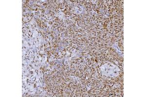 IHC analysis of SP1 using anti-SP1 antibody (ABIN7601559).