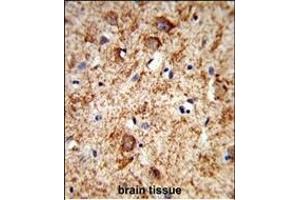 Formalin-fixed and paraffin-embedded human brain tissue reacted with PNOC Antibody (Center), which was peroxidase-conjugated to the secondary antibody, followed by DAB staining.