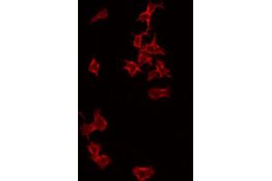 anti-Prefoldin Subunit 1 (PFDN1) (Internal Region) antibody