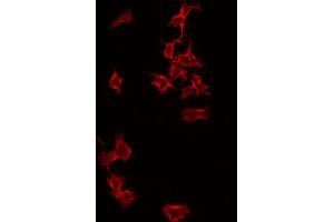 ABIN6266993 staining RAW264. (PFDN1 anticorps  (Internal Region))
