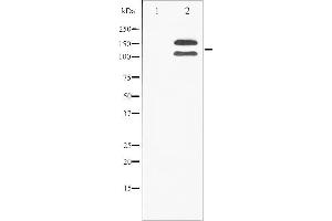 Western blot analysis of FGFR1 phosphorylation expression in 293 whole cell lysates,The lane on the left is treated with the antigen-specific peptide. (FGFR1 anticorps  (pTyr154))