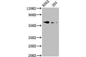 Western Blot Positive WB detected in: K562 whole cell lysate, 293 whole cell lysate All lanes: BMPR1A antibody at 3. (BMPR1A anticorps  (AA 177-532))