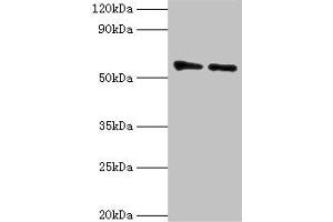 Western blot All lanes: OXCT1 antibody at 8 μg/mL Lane 1: Mouse heart tissue Lane 2: Mouse kidney tissue Secondary Goat polyclonal to rabbit IgG at 1/10000 dilution Predicted band size: 57, 14 kDa Observed band size: 57 kDa (OXCT1 anticorps  (AA 261-520))