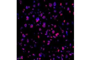 Immunofluorescence of paraffin embedded mouse placenta using Skar (ABIN7074970) at dilution of 1:950 (400x lens) (p46 anticorps)