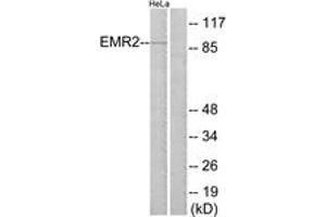 Western blot analysis of extracts from HeLa cells, using EMR2 Antibody. (EMR2 anticorps  (AA 121-170))
