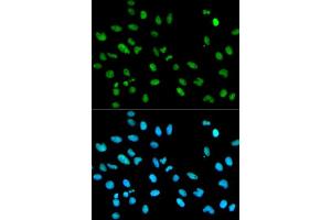 Immunofluorescence analysis of MCF-7 cells using RBBP4 antibody (ABIN5970697).