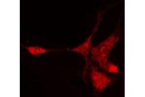 ABIN6276988 staining Hela cells by IF/ICC. (NR1I3 anticorps  (Internal Region))