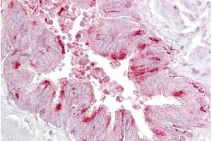 Immunohistochemistry with Lung, respiratory epithelium tissue at an antibody concentration of 5ug/ml using anti-EIF4E antibody