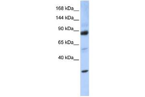 WB Suggested Anti-ZHX3 Antibody Titration: 0.