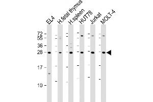 All lanes : Anti-TIGIT Antibody at 1:2000 dilution Lane 1: EL4 whole cell lysate Lane 2: human fetal thymus lysate Lane 3: human spleen lysate Lane 4: HUT78 whole cell lysate Lane 5: Jurkat whole cell lysate Lane 6: MOLT-4 whole cell lysate Lysates/proteins at 20 μg per lane.