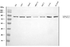 Western blot analysis of FFR/VPS51 using anti-FFR/VPS51 antibody (ABIN7601551).