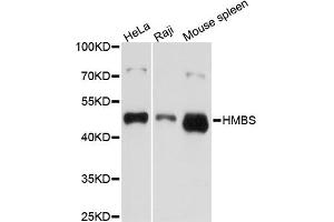 Western blot analysis of extracts of various cell lines, using HMBS antibody (ABIN5970895) at 1/1000 dilution. (HMBS anticorps)