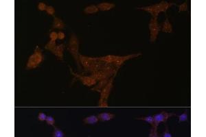 Immunofluorescence analysis of HeLa cells using PPAT Polyclonal Antibody at dilution of 1:100 (40x lens). (PPAT anticorps)