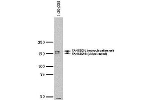 Image no. 1 for anti-Fanconi Anemia, Complementation Group D2 (FANCD2) (N-Term) antibody (ABIN363390)