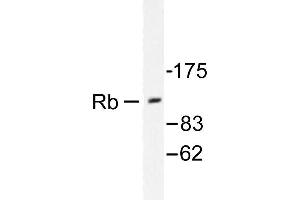 Image no. 2 for anti-Retinoblastoma 1 (RB1) antibody (ABIN271801) (Retinoblastoma 1 anticorps)