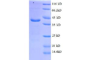 ATPase, H+ Transporting, Lysosomal 13kDa, V1 Subunit G1 (ATP6V1G1) (AA 2-118), (full length) protein (GST tag)