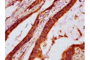 anti-7-Dehydrocholesterol Reductase (DHCR7) (AA 63-147) antibody