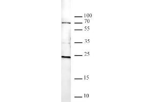 Histone H2AK119ub antibody tested by Western blot. (Histone H2A anticorps  (ubLys119))