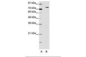 Image no. 1 for anti-MYST Histone Acetyltransferase 2 (MYST2) (N-Term) antibody (ABIN6736157) (MYST2 anticorps  (N-Term))