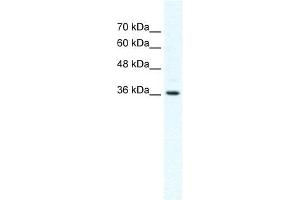 DVL1 antibody used at 2. (DVL1 anticorps)
