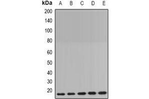 Western blot analysis of Cyclophilin B expression in MCF7 (A), HepG2 (B), mouse brain (C), mouse lung (D), rat liver (E) whole cell lysates. (PPIB anticorps)
