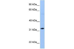 DNALI1 antibody used at 1 ug/ml to detect target protein. (DNALI1 anticorps  (C-Term))