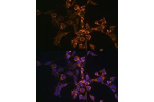Immunofluorescence analysis of NIH-3T3 cells using Septin 4 Polyclonal Antibody (ABIN6128476, ABIN6147554, ABIN6147555 and ABIN6214410) at dilution of 1:100 (40x lens).