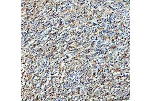 IHC analysis of SYK using anti-SYK antibody (ABIN7599608). (SYK anticorps  (AA 10-635))