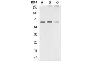 Western blot analysis of AMPK alpha 1/2 expression in HeLa (A), mouse brain (B), rat brain (C) whole cell lysates. (PRKAA1/PRKAA2 anticorps  (Center))
