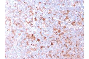 Formalin-fixed, paraffin-embedded human Tonsil stained with CD40L-Monospecific Mouse Monoclonal Antibody (CD40LG/2761). (CD40 Ligand anticorps  (AA 108-261))