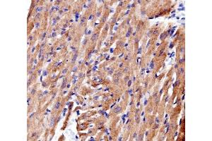 IHC analysis of ACTN2 using anti-ACTN2 antibody (ABIN7602055). (ACTN2 anticorps  (AA 567-696))