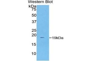 WB of Protein Standard: different control antibodies against Highly purified E.