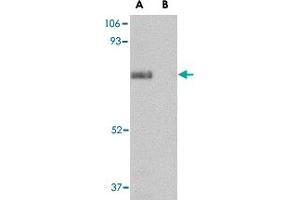 Western blot analysis of SCARB2 in human skeletal muscle tissue lysate with SCARB2 polyclonal antibody  at 1 ug/mL in (A) the absence and (B) presence of blocking peptide.