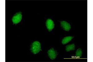 Immunofluorescence of purified MaxPab antibody to C8orf70 on HeLa cell. (FAM164A anticorps  (AA 1-325))