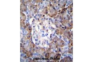 TIMP1 Antibody (C-term) immunohistochemistry analysis in formalin fixed and paraffin embedded human pancreas tissue followed by peroxidase conjugation of the secondary antibody and DAB staining. (TIMP1 anticorps  (C-Term))