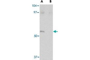 Western blot analysis of LASS5 in SK-N-SH lysate with LASS5 polyclonal antibody  at 1 ug/mL in the (A) absence and (B) presence of blocking peptide. (LASS5 anticorps  (C-Term))