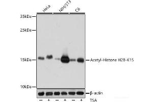 Western blot analysis of extracts of various cell lines using Acetyl-Histone H2B-K15 Polyclonal Antibody at dilution of 1:1000. (Histone H2B anticorps  (acLys15))