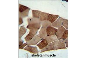 ST3GAL5 antibody immunohistochemistry analysis in formalin fixed and paraffin embedded human skeletal muscle followed by peroxidase conjugation of the secondary antibody and DAB staining.