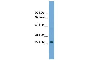 RAB39 antibody used at 1 ug/ml to detect target protein. (RAB39 anticorps  (N-Term))