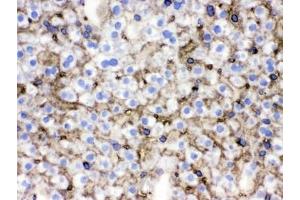 IHC testing of frozen mouse liver tissue with NTCP antibody.
