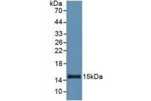 Detection of Recombinant SAA, Human using Monoclonal Antibody to Serum Amyloid A (SAA)
