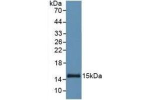 Detection of Recombinant SAA, Human using Monoclonal Antibody to Serum Amyloid A (SAA) (SAA anticorps  (AA 19-122))